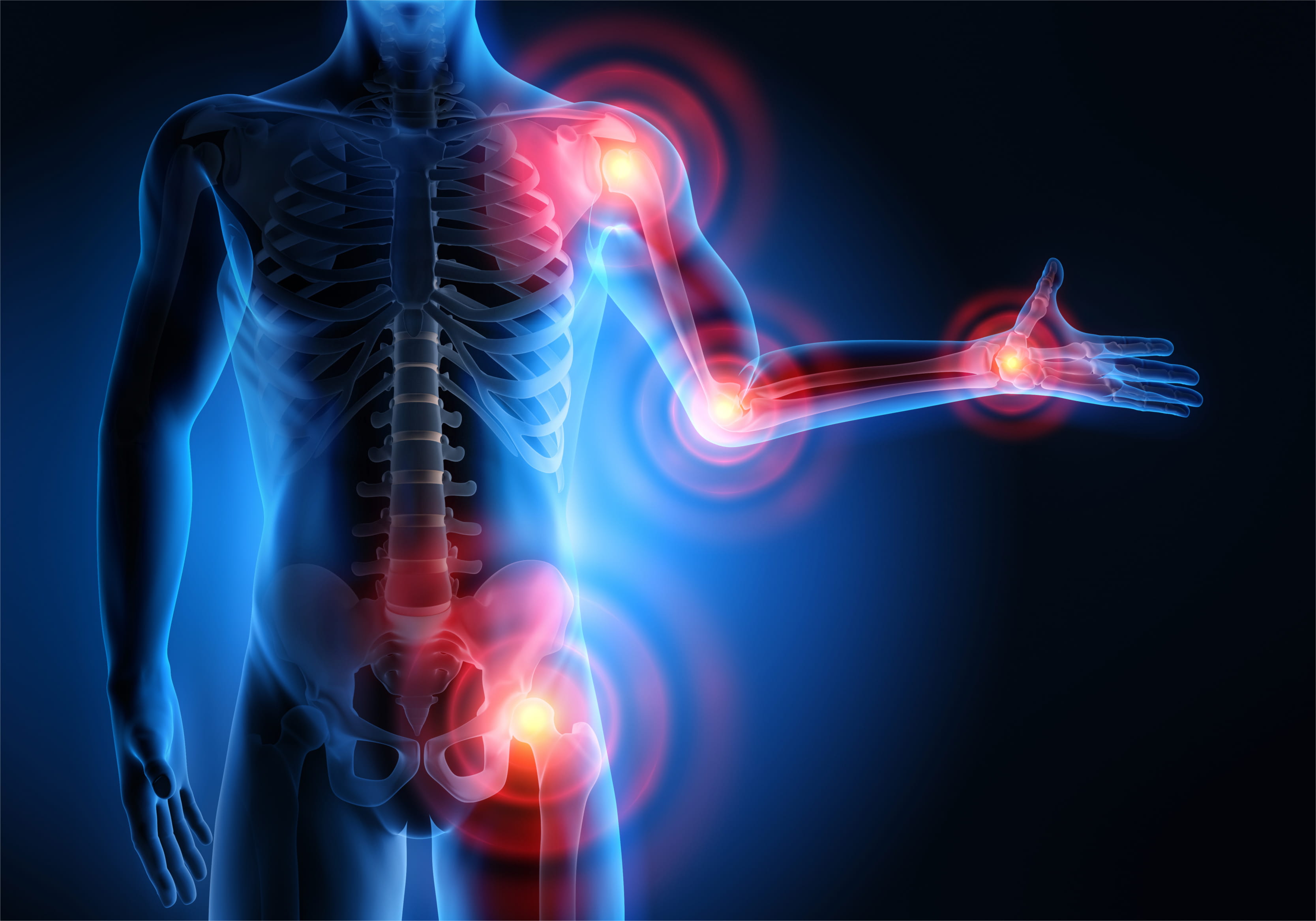 Prolotherapy